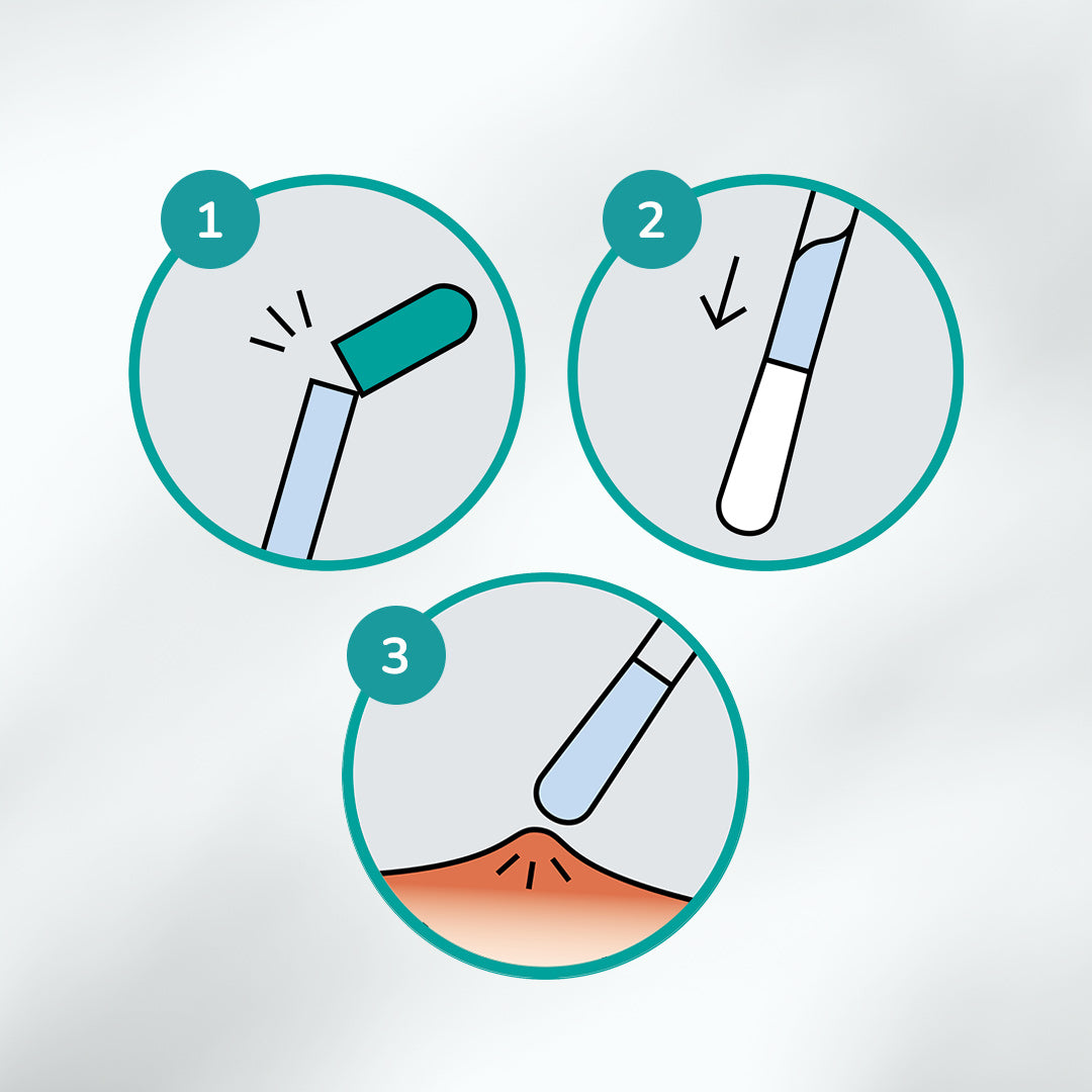 Dreistufige Anleitung zur Knicktechnik der CLICswab-Wattestäbchen: 1. Grünes Ende abknicken, 2. Serum fließt in die Wattespitze, 3. Punktgenau auf die betroffene Hautstelle auftragen.