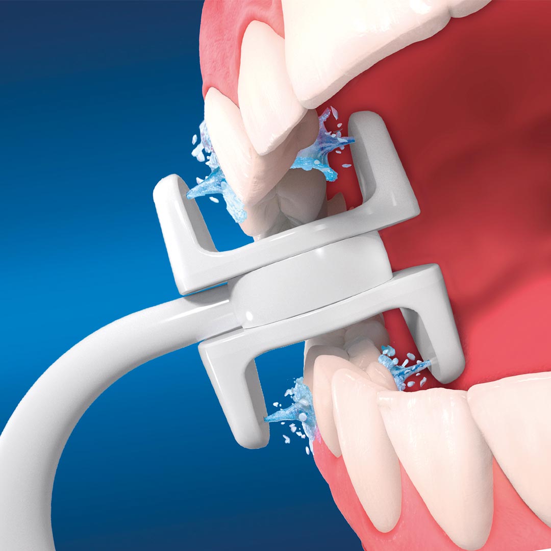 CorpCare Miracle Smile reinigt mit Wasserstrahl präzise die Zahnzwischenräume von Ober- und Unterkiefer.